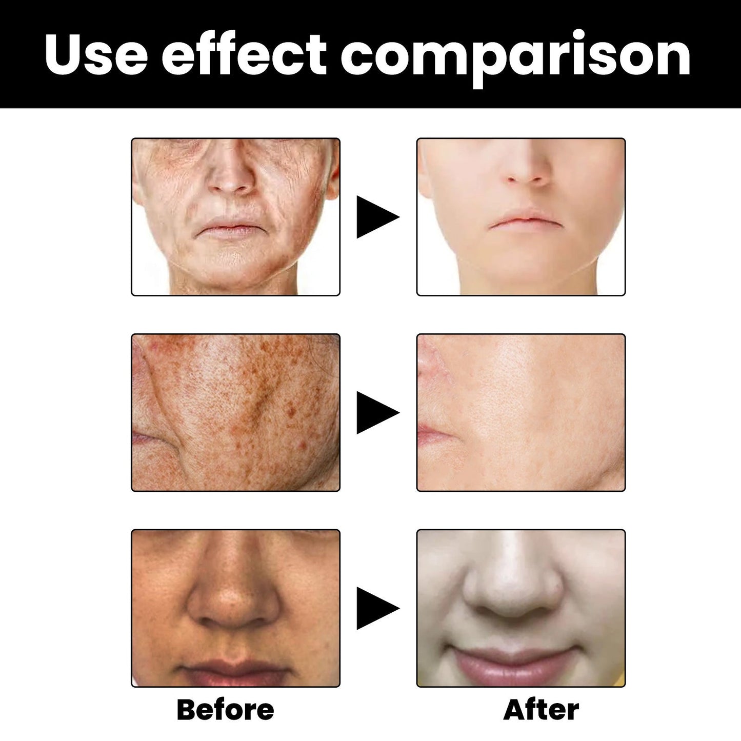 Facial Melanin Repair Hydrating Skincare Products